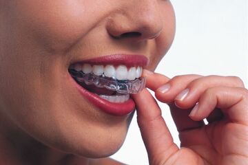 Invisalign®: The Next Evolution of Braces