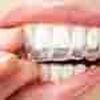 Orthodontics Small